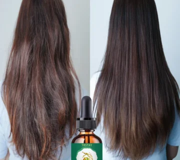 A57b62d458b2944b48bb3ab31f331c4deP