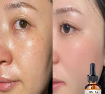 Discover Deep Hydration Without Irritation: Alcohol-Free Brightening Facial Oil for Sensitive Skin Aacbba71025594de493dfdb27d4c2b401d